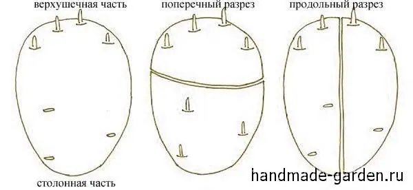 Кольцевой разрез может быть&nbsp;поперечным&nbsp;и&nbsp;продольным.